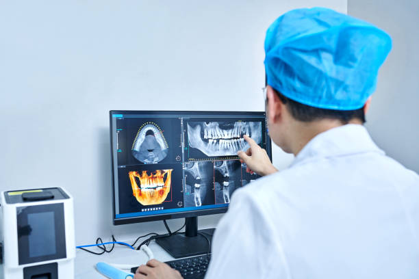 Best Knocked-Out Tooth (Avulsed Tooth) Treatment in Haw River, NC